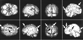 разные проекции мозга