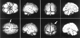 разные проекции мозга