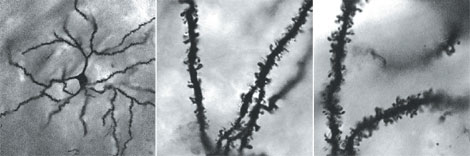 Микрофотографии прилежащего ядра животных, находящихся под воздействием ненаркотических веществ