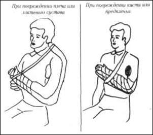 Параплан - медицина