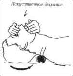 Параплан - медицина