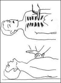 Параплан - медицина