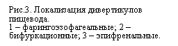 Подпись: Рис.3. Локализация дивертикулов пищевода.
1 – фарингоэзофагеальные; 2 – бифуркационные; 3 – эпифренальные.
