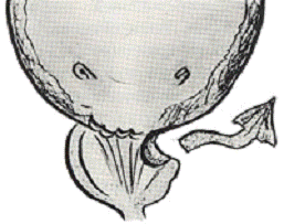 Паравезикальная клетчатка. Парапростатическая клетчатка. Парапростатическая клетчатка предстательной железы. Парапростатическая клетчатка анатомия. Паравезикальное пространство.