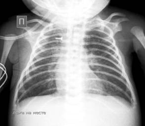 Гашимов Ю 2 мес 4.10.bmp