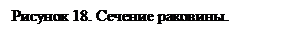 Подпись: Рисунок 18. Сечение раковины.