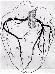 посегментное деление коронарных артерий сердца: А — правая коронарная артерия, Б — левая коронарная   артерия