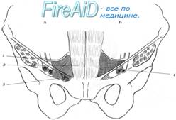 Треугольник Гессельбаха. Границы треугольника Гессельбаха. Роковой треугольник. Треугольник боли.