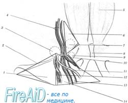 Треугольник Гессельбаха. Границы треугольника Гессельбаха. Роковой треугольник. Треугольник боли.