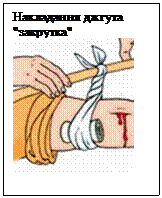 Подпись: Накладання джгута "закрутка" 