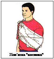 Подпись:           
Пов’язка "косинка"
