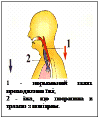 Подпись:  
1 - нормальний шлях 
проходження їжі;
2 - їжа, що потрапила в трахею з повітрям.
