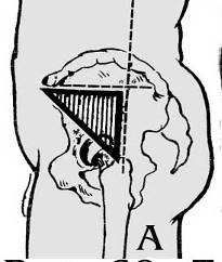 Теугольник Бриана