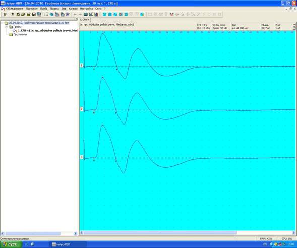общий скрин.JPG