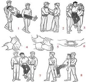 Переноска пострадавшего двумя носильщиками